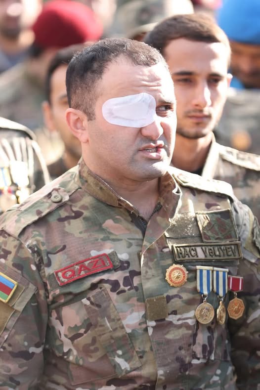 Hacı Vəliyev göz institutuna göndərilməsini istəyir