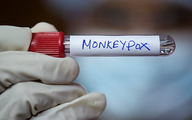 Qonşuda meymunçiçəyi yayılıb – risk varmı?